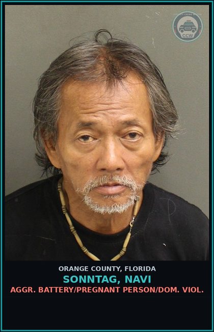 CCW arrest card for SONNTAG, NAVI in Orange County: DUI-UNLAW BLD ALCH-DUI INFLUENCE OF ALCOHOL OR DRUGS
