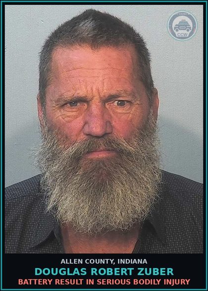 CCW arrest card for Douglas Robert Zuber in Allen County: BATTERY RESULT IN SERIOUS BODILY INJURY